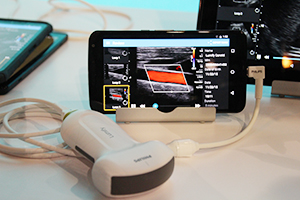 Android端末を使った超音波診断装置「Lumify」