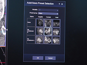 syngo.viaの“AutoViews Preset Selection”機能