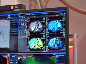 手技中にパーフュージョン撮影を行うことで血流の確認が可能
