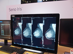 マンモグラフィ用画像診断ワークステーション「SenoIris」