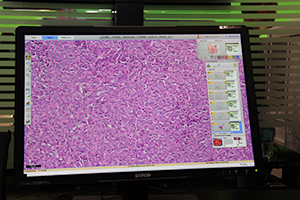 Digital Pathologyシステムのビューワ（本システムは医療機器ではない）