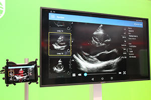 心臓検査も可能になった「Lumify」（日本国内薬機法未承認）の画像を大型ディスプレイに出力して展示