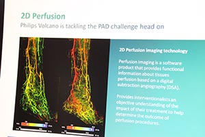下肢末梢血管を可視化する“2D Perfusion”