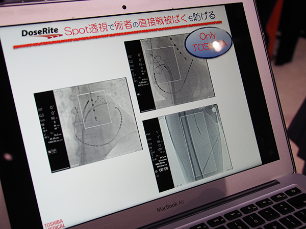 関心領域に絞って透視を行い被ばく線量を半減するスポット透視機能