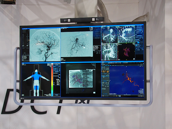 線量管理システム“DoseRite DTS（Dose Tracking System）”（左下）を表示した大型モニタ