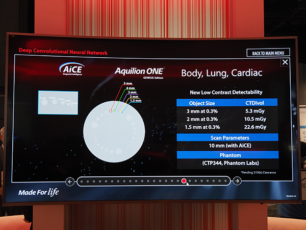 コントラスト分解能がさらに向上し，AiCEでは1.5mm径まで検出可能