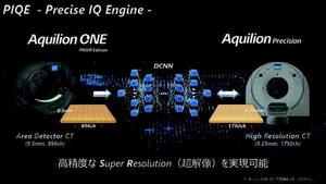 ADCT の画像を高精細化する“Precise IQ Engine（PIQE）”