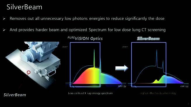 低線量肺がん検診をターゲットとした“SilverBeam Filter”