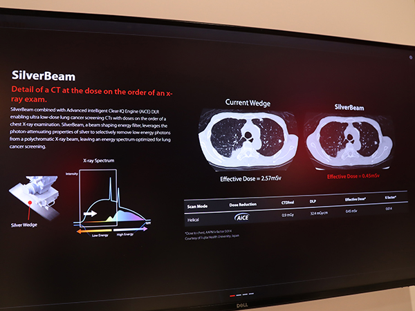 AiCEと「SilverBeam Filter」の併用により従来の1/5以下の実効線量で同等の画像を得られ，肺がんCTスクリーニング検査での活用が期待される。