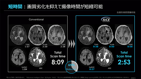 画質の劣化抑制により撮像時間の短縮にも活用できる