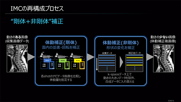 剛体＋非剛体補正により体動を補正するIMC