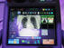 米国でも注目を集めるX線動態撮影（Dynamic Digital Radiography）