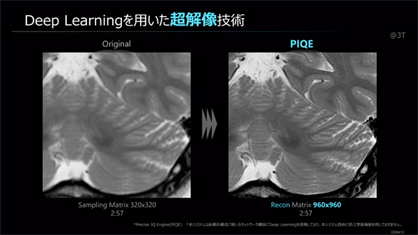 マトリックスを3倍に引き上げられる超解像画像再構成技術「PIQE」