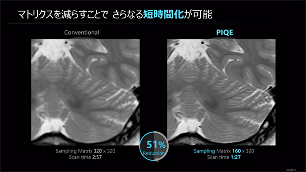 サンプリングマトリックスを下げて撮像時間を短縮しても，PIQEにより従来よりも高分解能の画像を取得可能