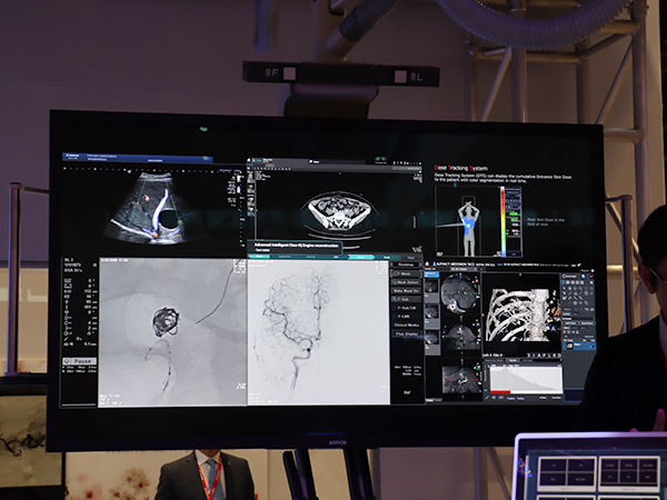 高精細検出器「Hi-Def Detector」による高画質画像で精緻なカテーテル手技をサポート