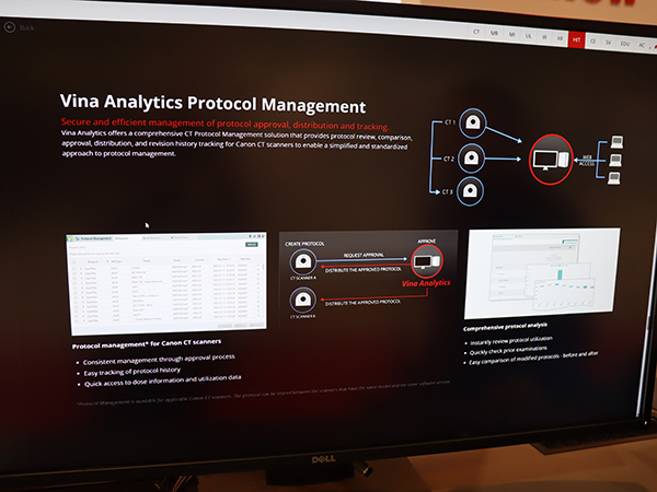 3つの機能でCT検査を支援する「Vina Analytics」
