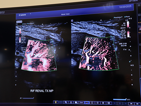 「SMI Angioモード」（右）では従来のSMI（左）よりも微細血管を明瞭に描出