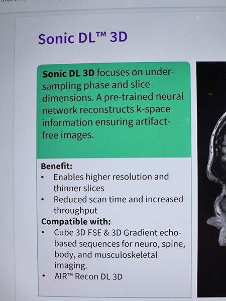 「MR 31」でさらなる高速化が進んだ「Sonic DL 3D」