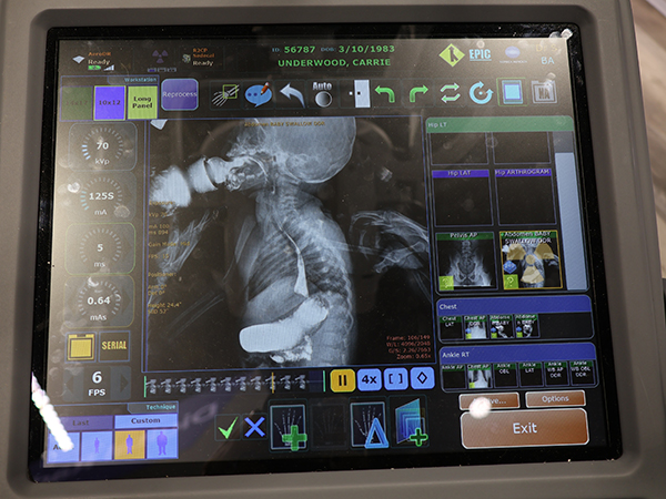 mKDR Xpressのコンソール画面で嚥下機能評価の画像を紹介