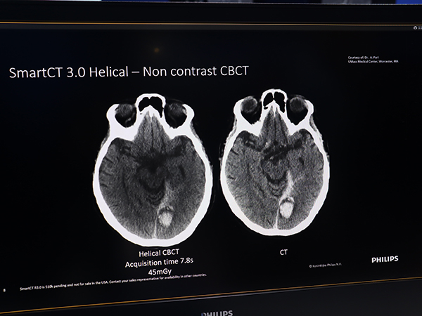 Helical CBCTにより軟部組織の画質を大幅に向上した「SmartCT 3.0」