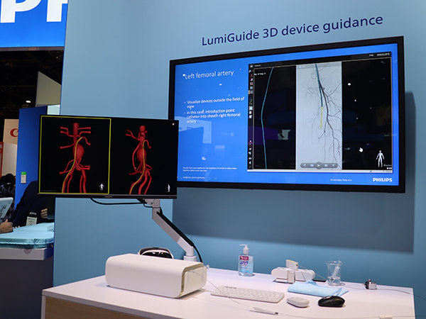 X線を使わない3Dデバイスガイダンス「LumiGuide」