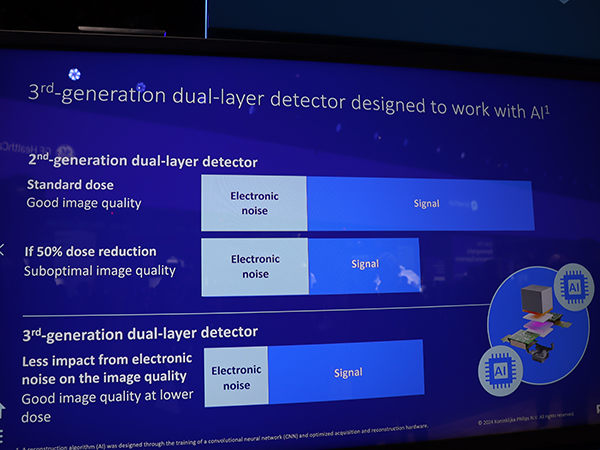 集積回路レベルから刷新された第3世代の二層検出器はAI画像再構成に最適化