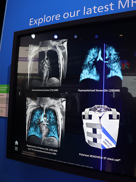 キセノンMRIでは肺換気の様子を直接的に可視化可能