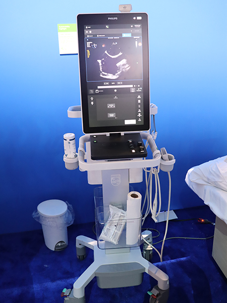 ポイントオブケアをターゲットにした超音波診断装置「Flash 5100」（日本国内での展開は未定）