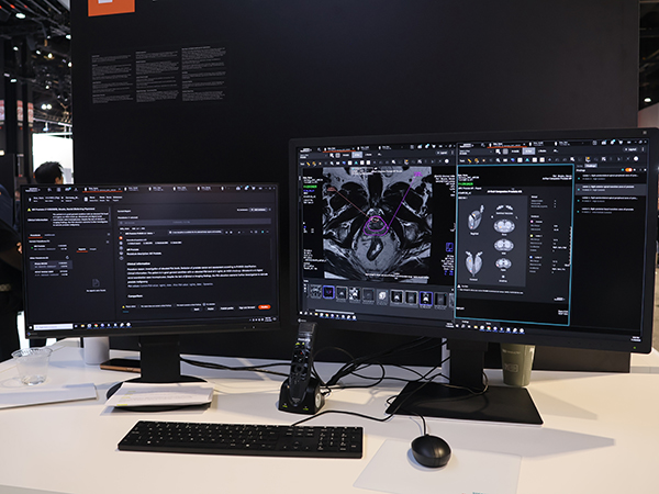Syngo Carbonでのレポーティングの画面例