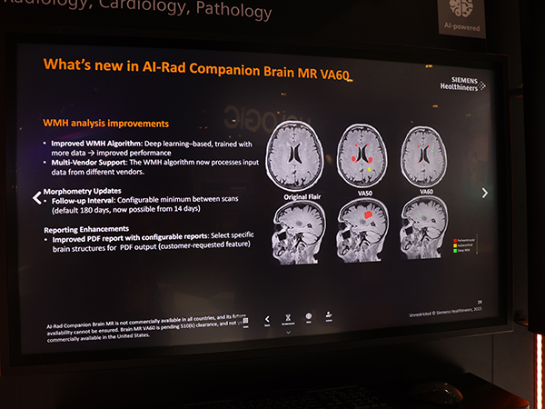 アップデートされた頭部MRI画像診断支援の「Brain MR」の概要