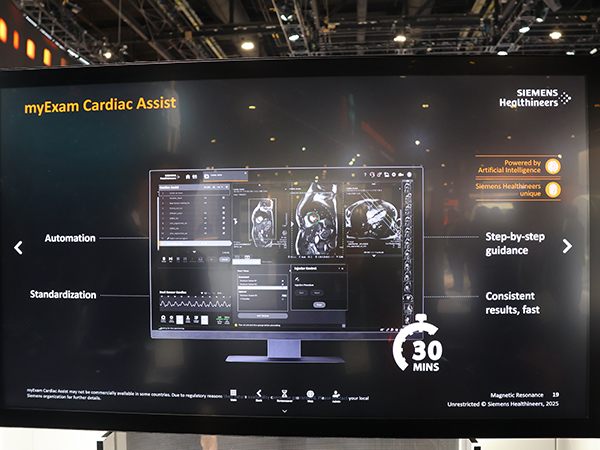 心臓撮像における断面設定の自動化技術「myExam Cardiac Assist」