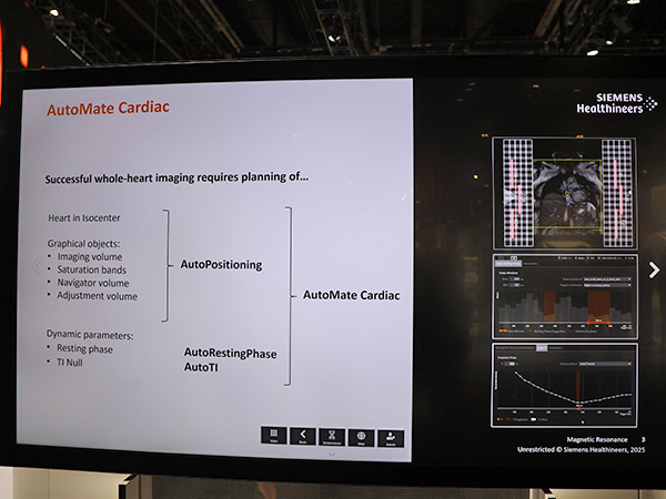 心臓の撮像位置設定や撮像条件設定の自動化などを包括した「AutoMate Cardiac」
