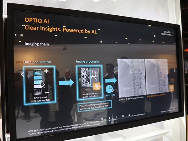 AIを用いて画像のノイズを除去する画像再構成法「OPTIQ AI」