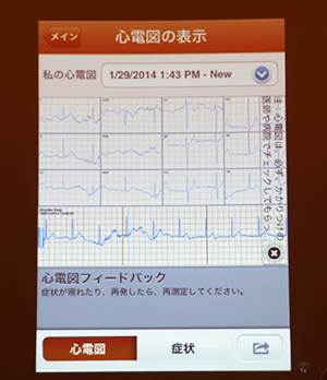 スマートフォンなどで12誘導心電図が確認できる。