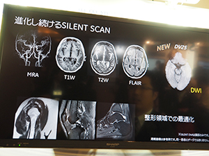 “SILENT SCAN”は，DWIにも対応