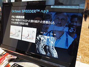 被検者の負担を軽減する“Octave SPEEDR”コイル