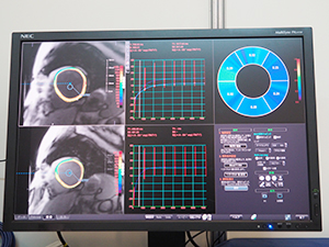 “MR心筋T1マッピング”などの最新アプリケーションをデモ