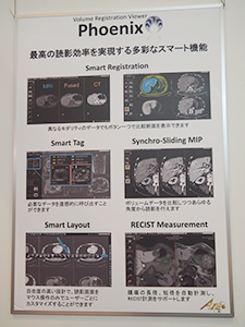 「AZE Phoenix」に搭載されるMRI用アプリケーションを紹介