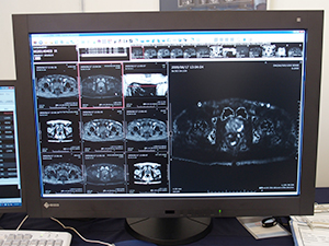cDWIのアプリケーションを搭載した読影用ビューワ“EV Insite R”