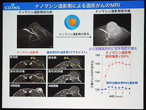 高信号でがんを描出するMRI用ナノマシン造影剤