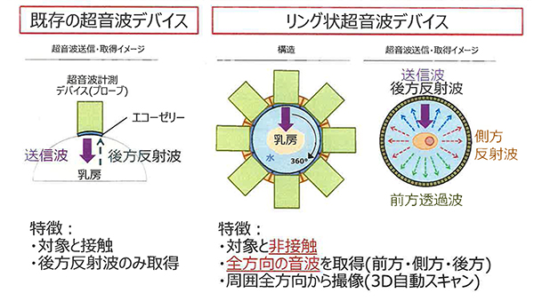 図2：リング状超音波デバイスの構造