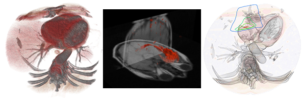 医用データによる融合可視化・透視可視化の画像例