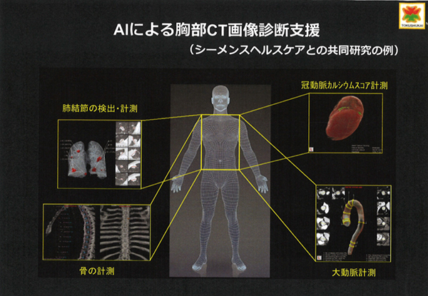 胸部CT画像診断支援ソフトウエアの実用化に向けた共同研究