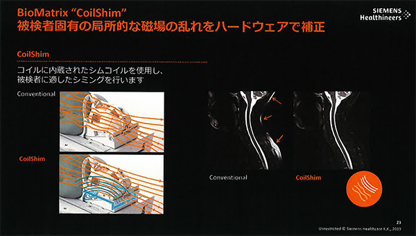 被検者に適したシミングを行い画質向上に寄与する“BioMatrix Tuners”の“Coilshim”