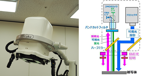 アームシステムは片手で容易に操作可能で，術中のストレスを軽減する。また，術者がすべての操作が可能なように，ヘッド部分にボタンを配置した。右は，MIPSヘッド内部構造（プレスリリースより）アームシステムは片手で容易に操作可能で，術中のストレスを軽減する。また，術者がすべての操作が可能なように，ヘッド部分にボタンを配置した。右は，MIPSヘッド内部構造（プレスリリースより）