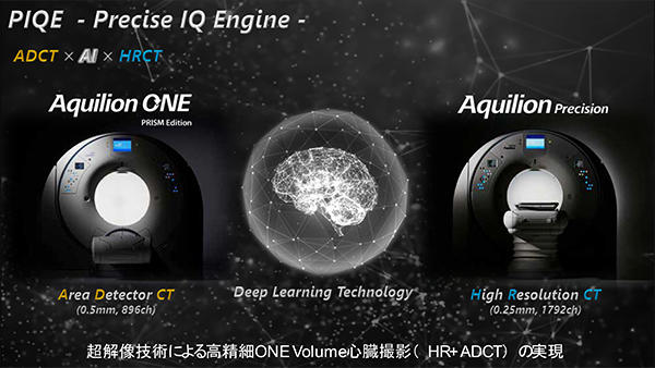 RSNA2021に合わせて超解像画像技術“PIQE”など新技術を発表