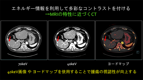 エネルギー情報を活用した多彩なコントラスト画像の出力