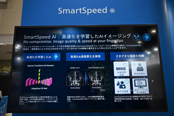 ワークフローの最適化に寄与する「SmartSpeed AI」