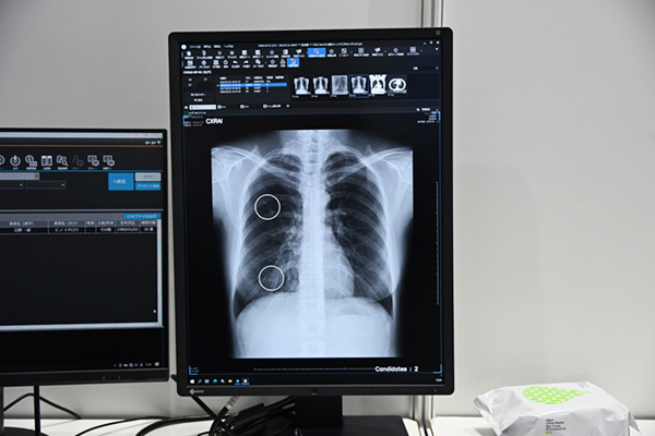 コニカミノルタの胸部X線画像診断支援AI「CXR Finding-i」