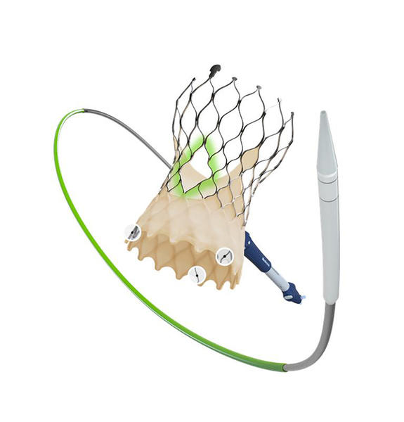 経カテーテル大動脈弁置換術（TAVR）用デバイス「Evolut FX＋ System」